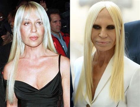 donatella versace 2015|donatella versace before and after.